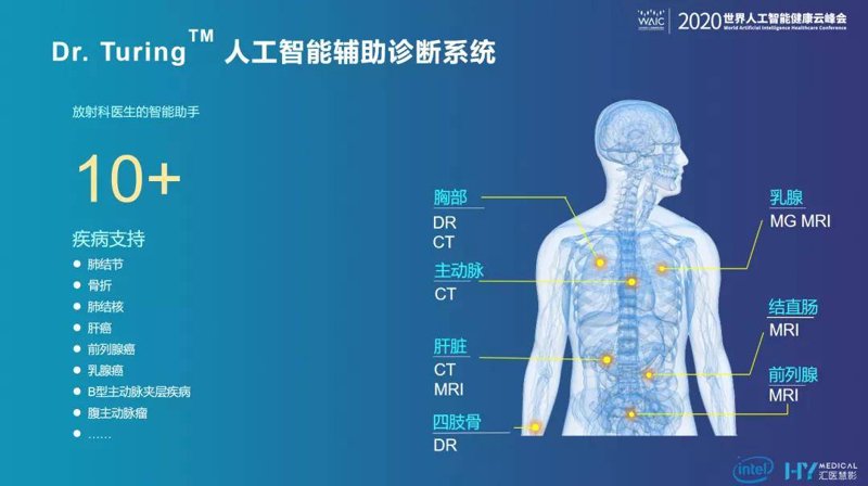 医疗AI算法选购指南：助力精准诊断