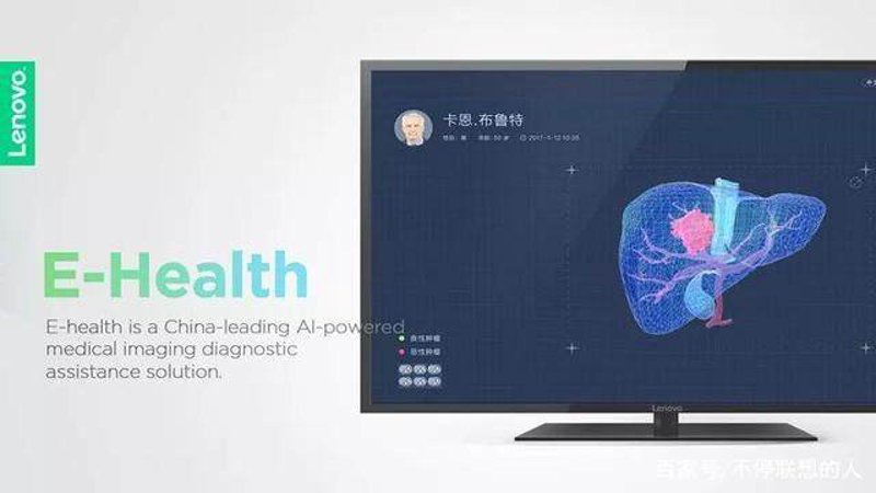 智能辅助诊断系统的革新力量